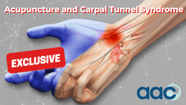 Acupuncture and Carpal Tunnel Syndrome