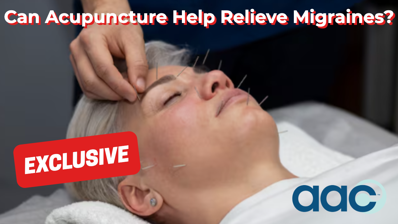 HD_Can Acupuncture Help Relieve Migraines_ Can Acupuncture Help Relieve Migraines?