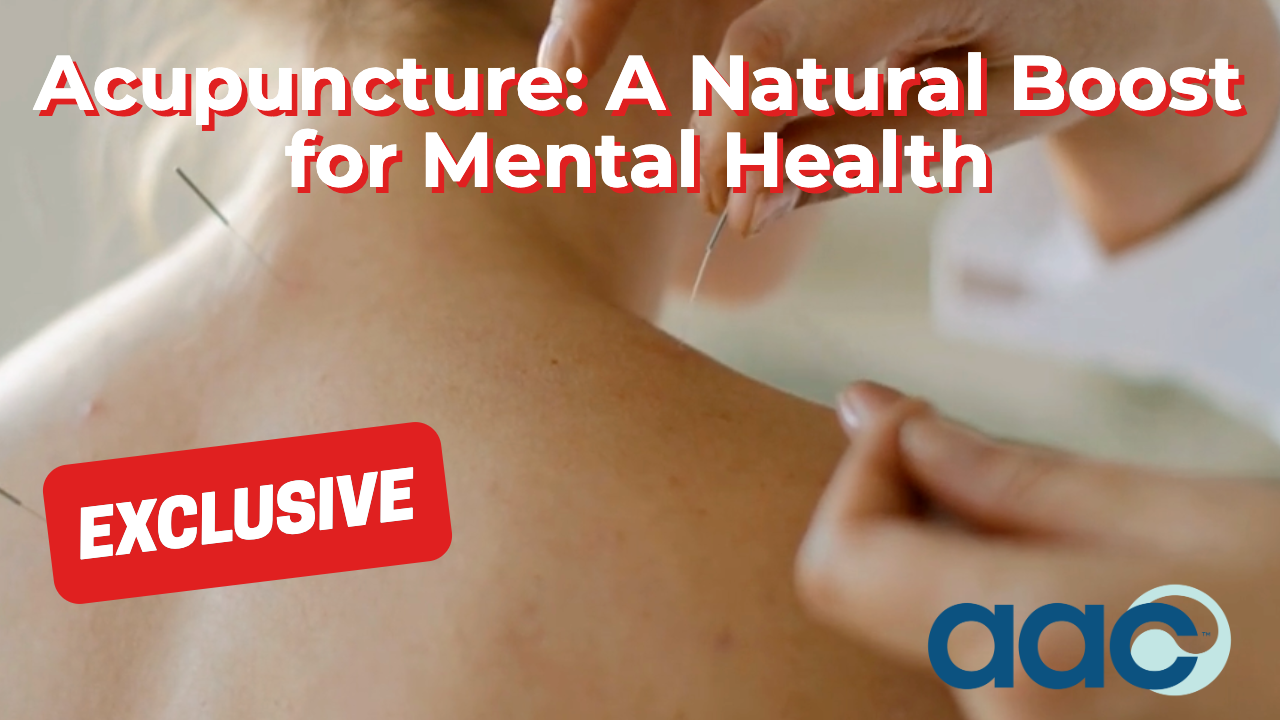 HD_Acupuncture_ A Natural Boost for Mental Health Acupuncture: A Natural Boost for Mental Health