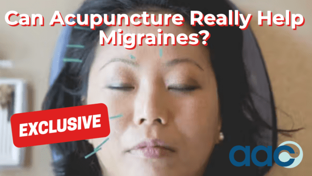Can Acupuncture Really Help Migraines?