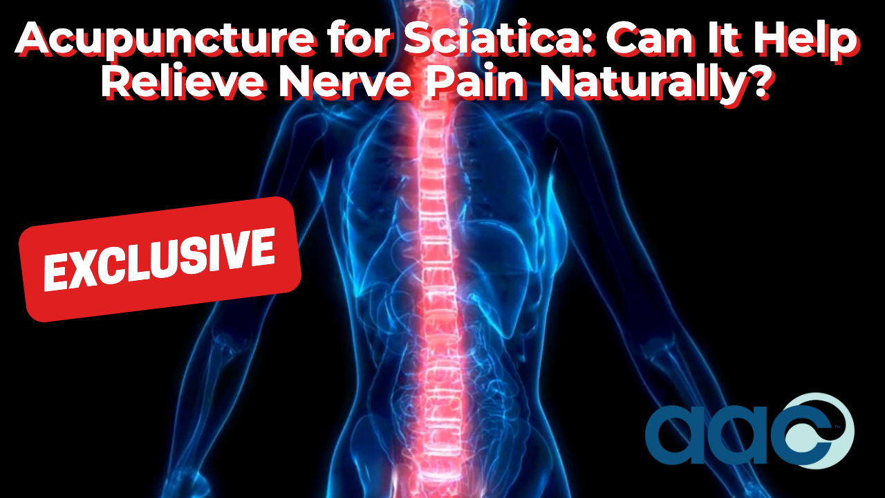 Acupuncture for Sciatica: Can It Help Relieve Nerve Pain Naturally?