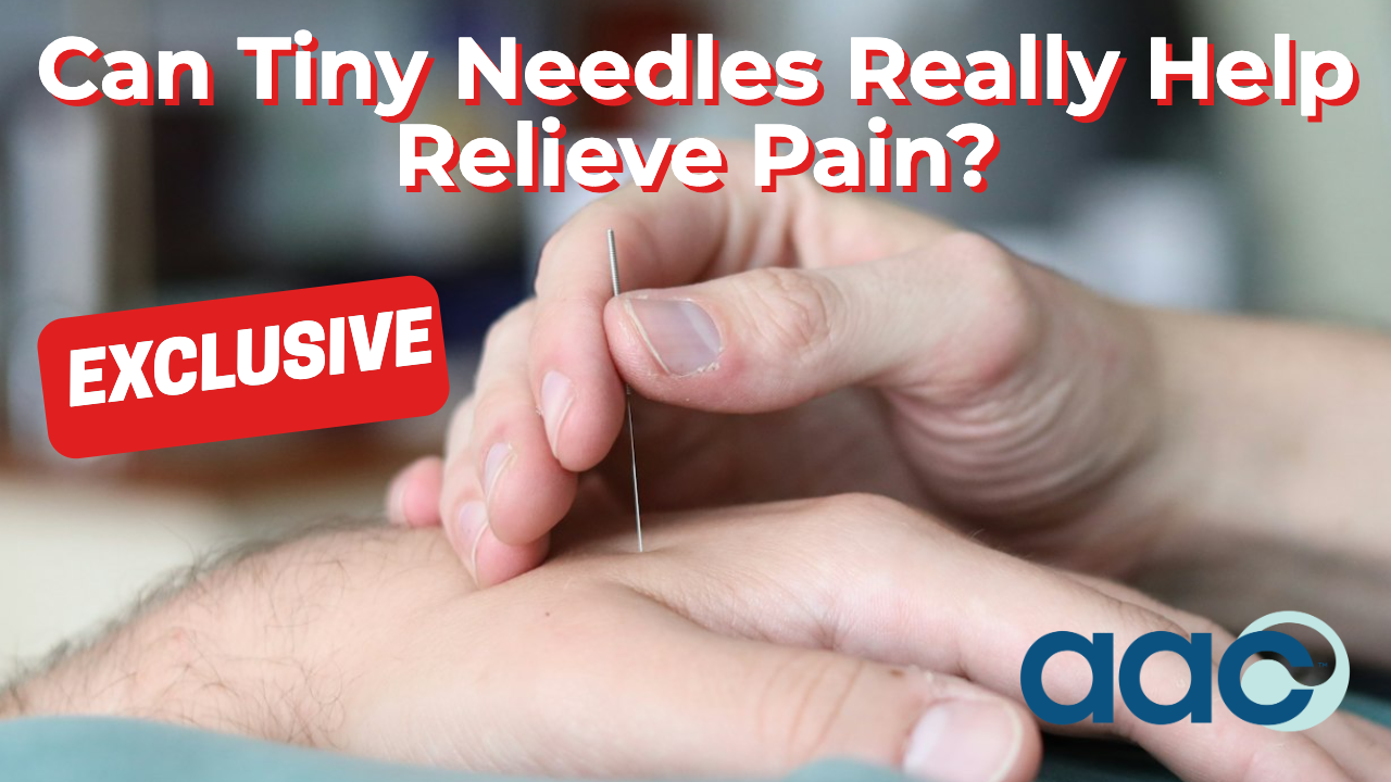 Acupuncturist inserting a thin needle during treatment for musculoskeletal pain